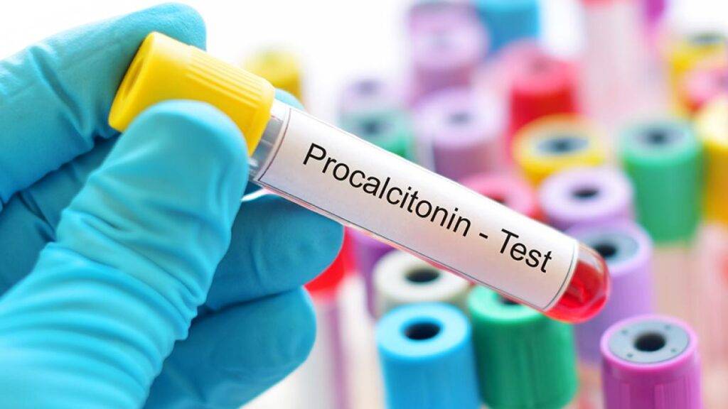 Procalcitonine (PCT)