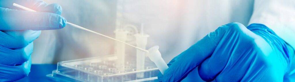 Information tests Covid-19