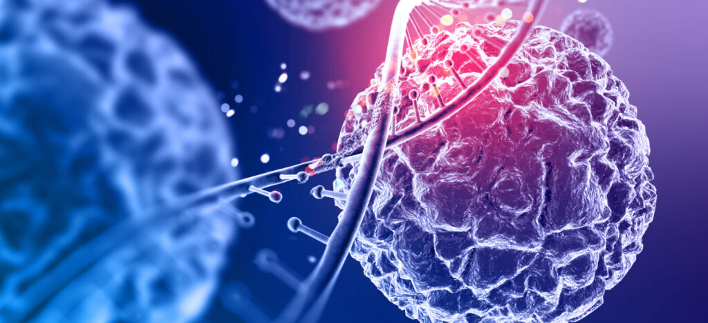 Evaluation de l’expression de TRBC1 dans le diagnostic des syndromes lymphoprolifératifs T