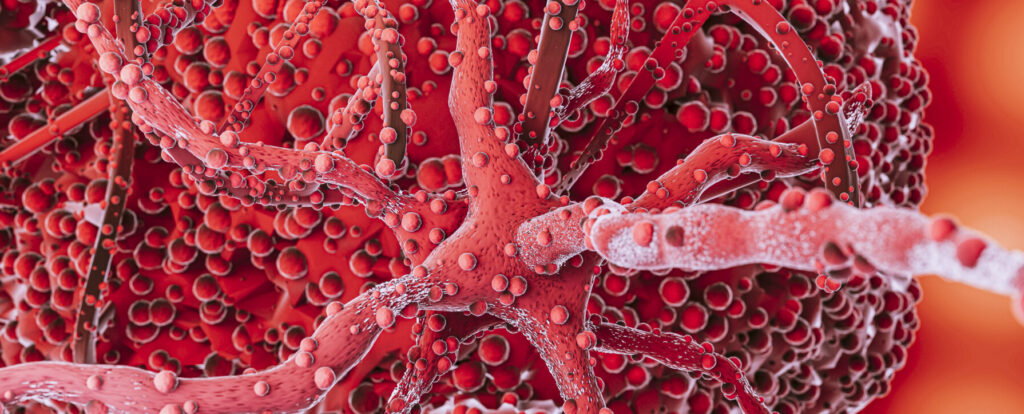 Pseudo-thrombopénie à l’EDTA, si on en parlait ?