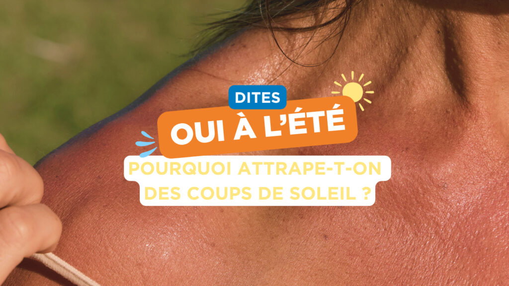 Pourquoi attrape-t-on des coups de soleil ? ☀️